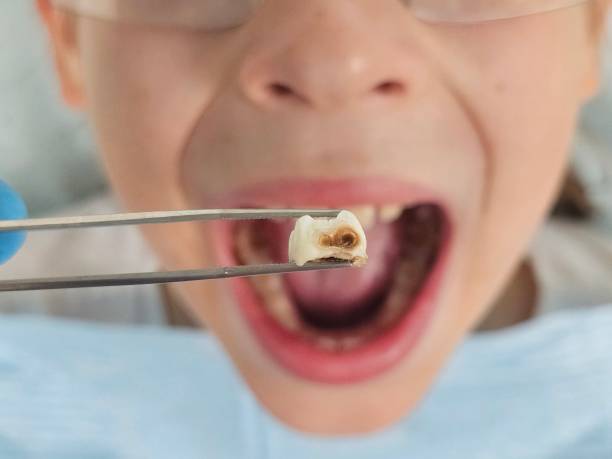 Best Mobile Emergency Dentist in New Knoxville, OH